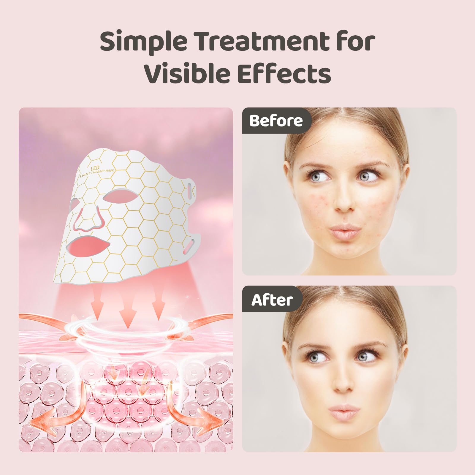 Yahi Red Light Photon Facial & Neck Mask with Remote Control, 7 Custom Modes with Infrared, Portable & Rechargeable with Timer for Home Use, 175 High-Density Light Beads, Black
