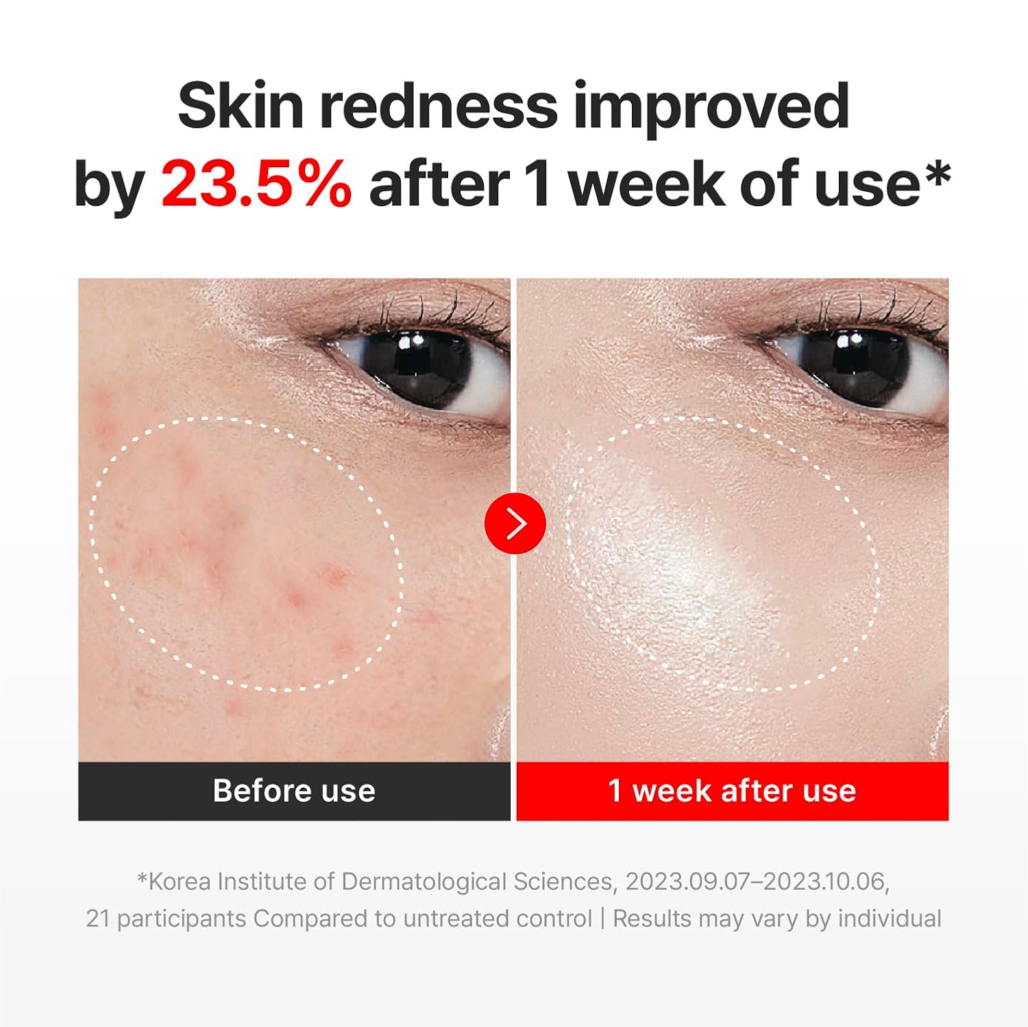 CENTELLIAN 24 Madeca Cream Time Reverse (1.69fl oz) - Advanced Fast-Absorbing & Nourishing, Hydrates, Firms & Reduces Wrinkles, Low Irritation, Korean Skin Care Centella Asiatica, Collagen